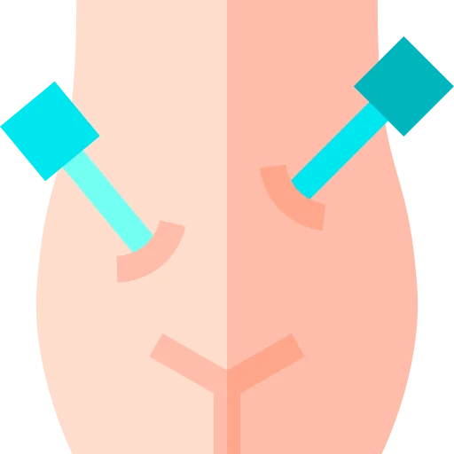 Laparoscopic